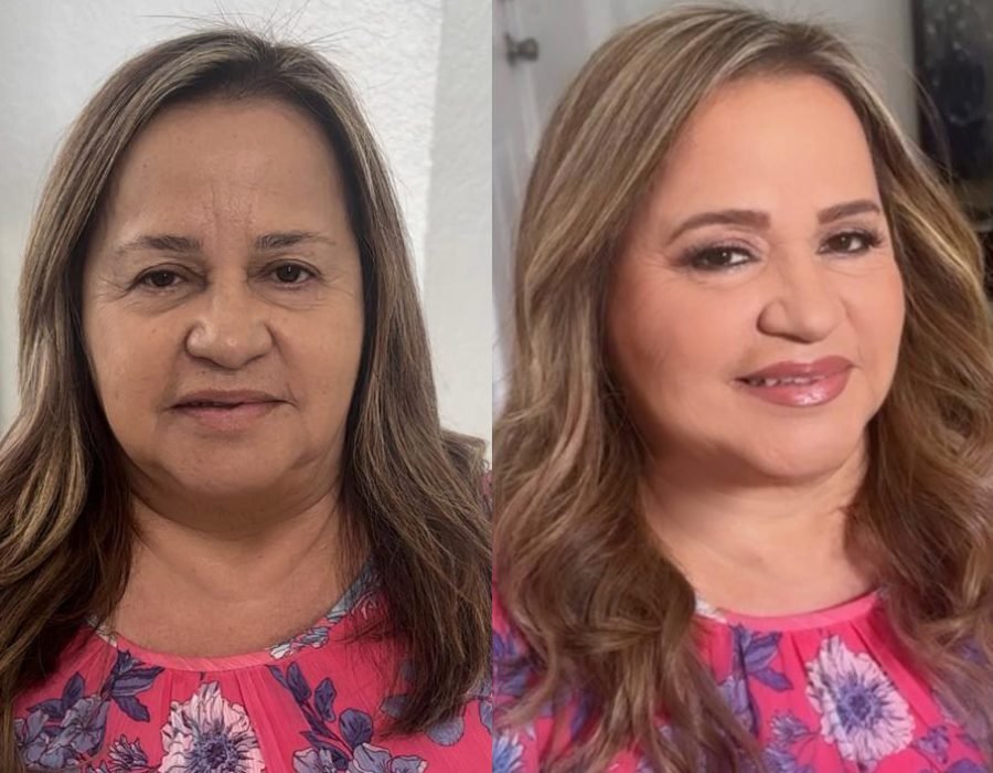 before and after close-up photos highlighting refined skin tone and natural lighting
